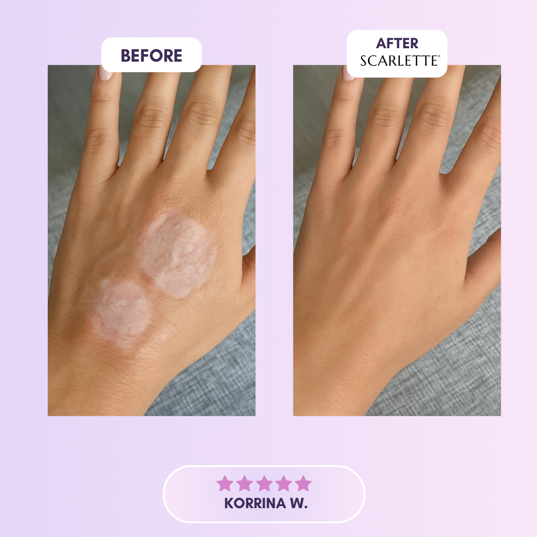 Scarlette™ Silicone Collagen Sheet