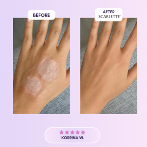 Scarlette™ Silicone Collagen Sheet