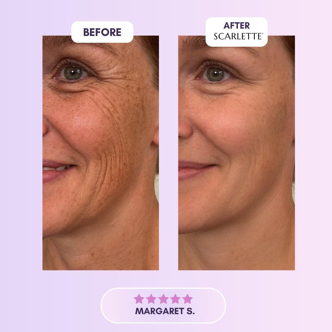 Scarlette™ Silicone Collagen Sheet