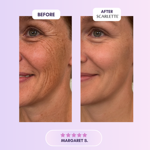 Scarlette™ Silicone Collagen Sheet